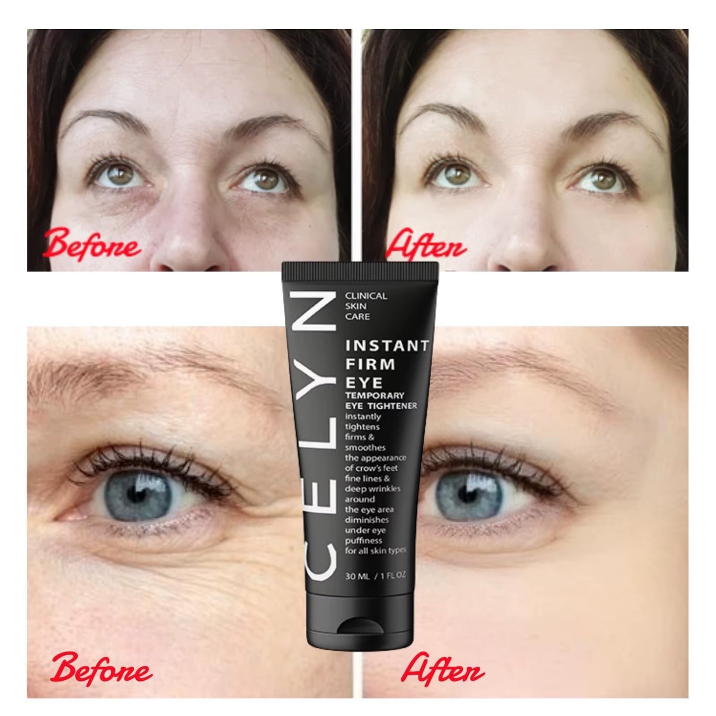 Instant Firm Eye Tightener, Eye Cream, Eye Firming Agent, Eye Lifting, Firming, Removing Eye Bags, Wrinkle Removal, and Eye Care