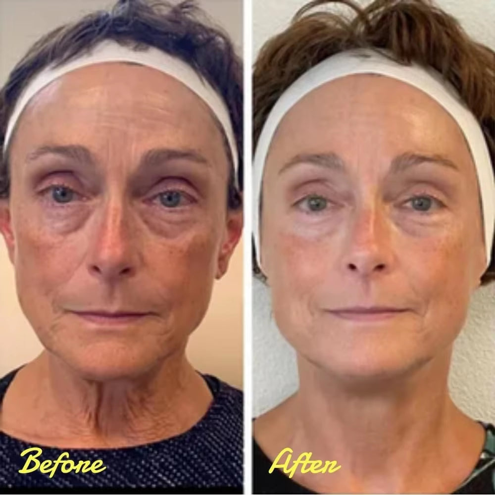 Instant Firm Eye Tightener, Eye Cream, Eye Firming Agent, Eye Lifting, Firming, Removing Eye Bags, Wrinkle Removal, and Eye Care